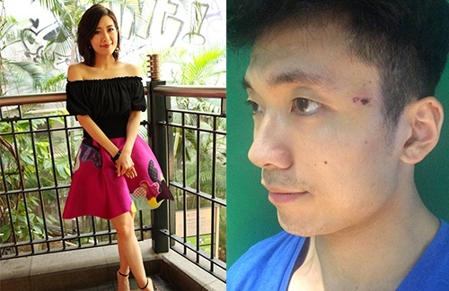 mandy-wong-winston-tsang-injury-2016.jpg