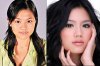 Plastic-surgery-Chrissie-Chaue.jpg