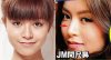 plastic-surgery-janice-man.jpg